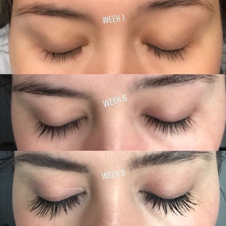 eye lash growth serum