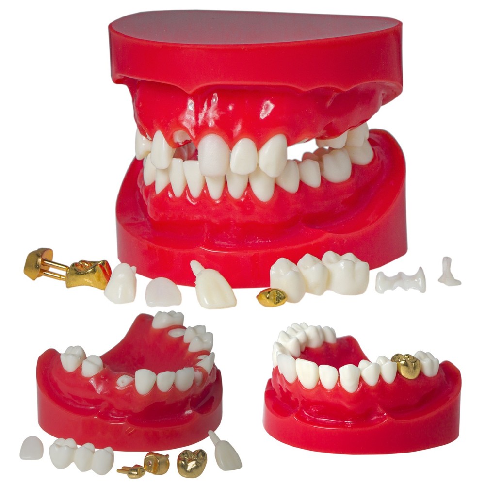 Dental M6004 Teaching Typodont Restoration Teeth Model Crown Post Core Bridge