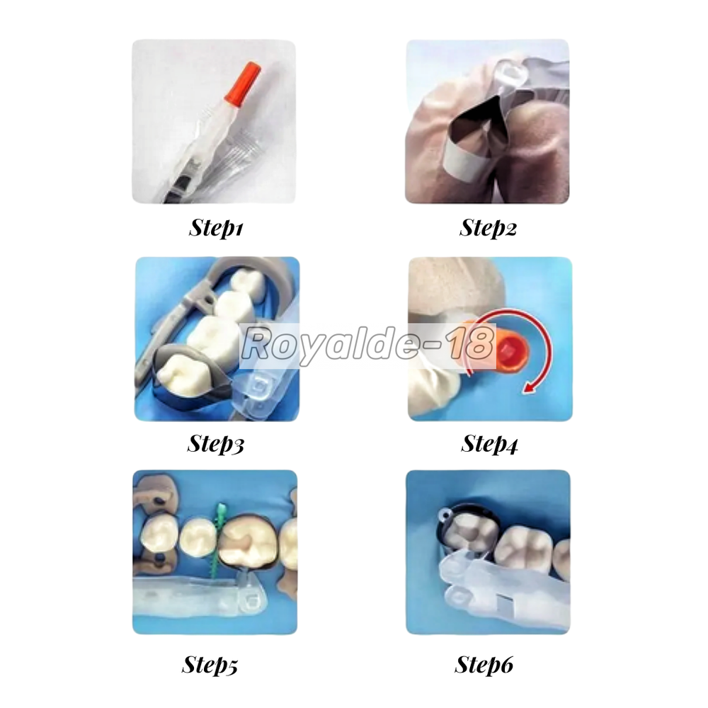 Dental Adjustable Matrix System Sectional Contoured Matrice Roll Type Green