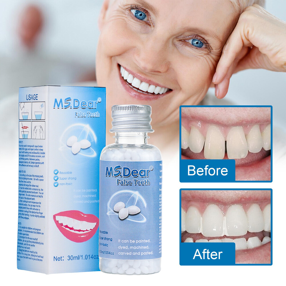 5/3x Tooth Repair Granules Temporary Reusable Moldable False Teeth Fitting Beads