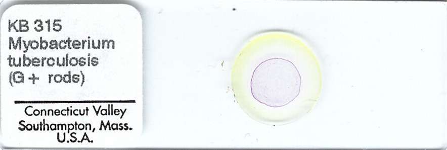 Mycobacterium tuberculosis Microscope Slide