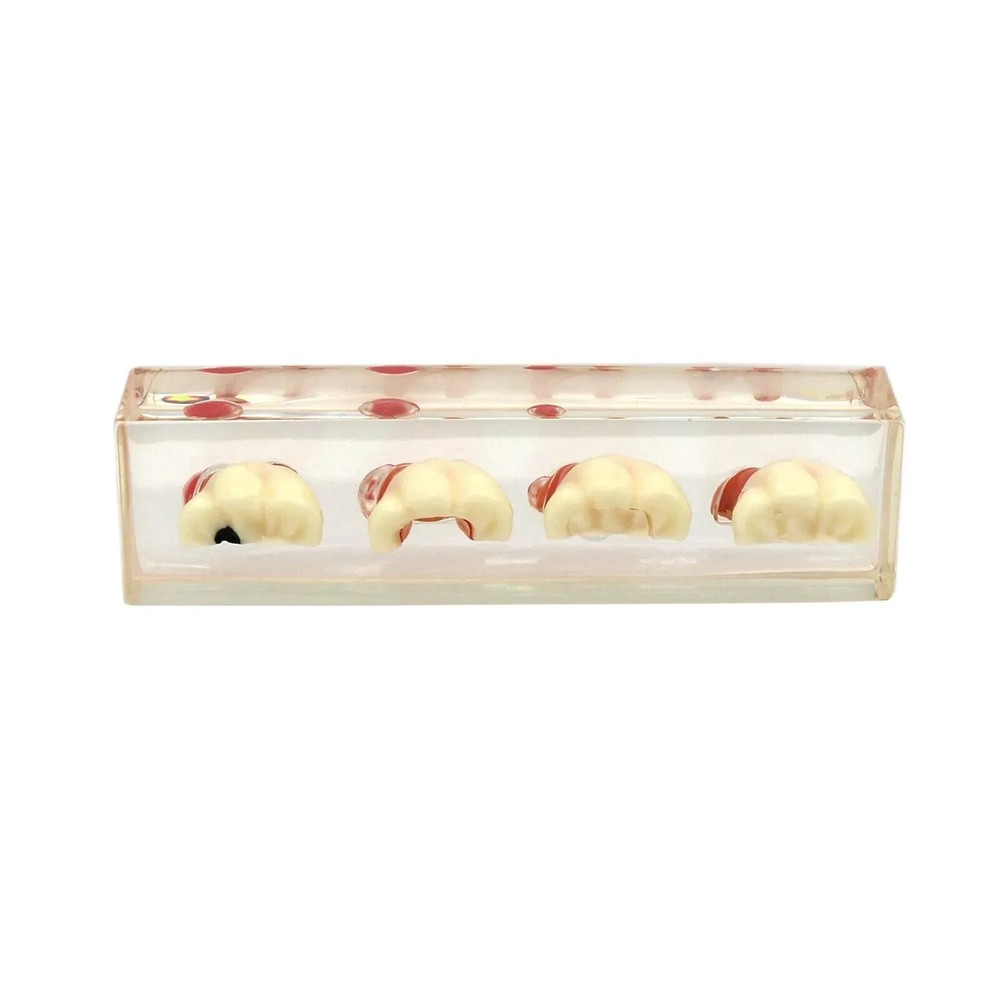Dental Endodontic Treatment Study Teaching Typodont Teeth 4018 Model 4 Stage