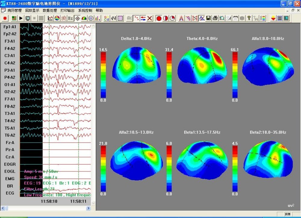Professional 24-Channel EEG Brain Mapping Software | KT88-2400 System