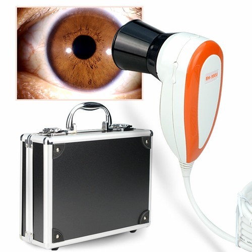 New 5.0MP USB Iriscope Iris Analyzer Iridology Camera with Iris English Software