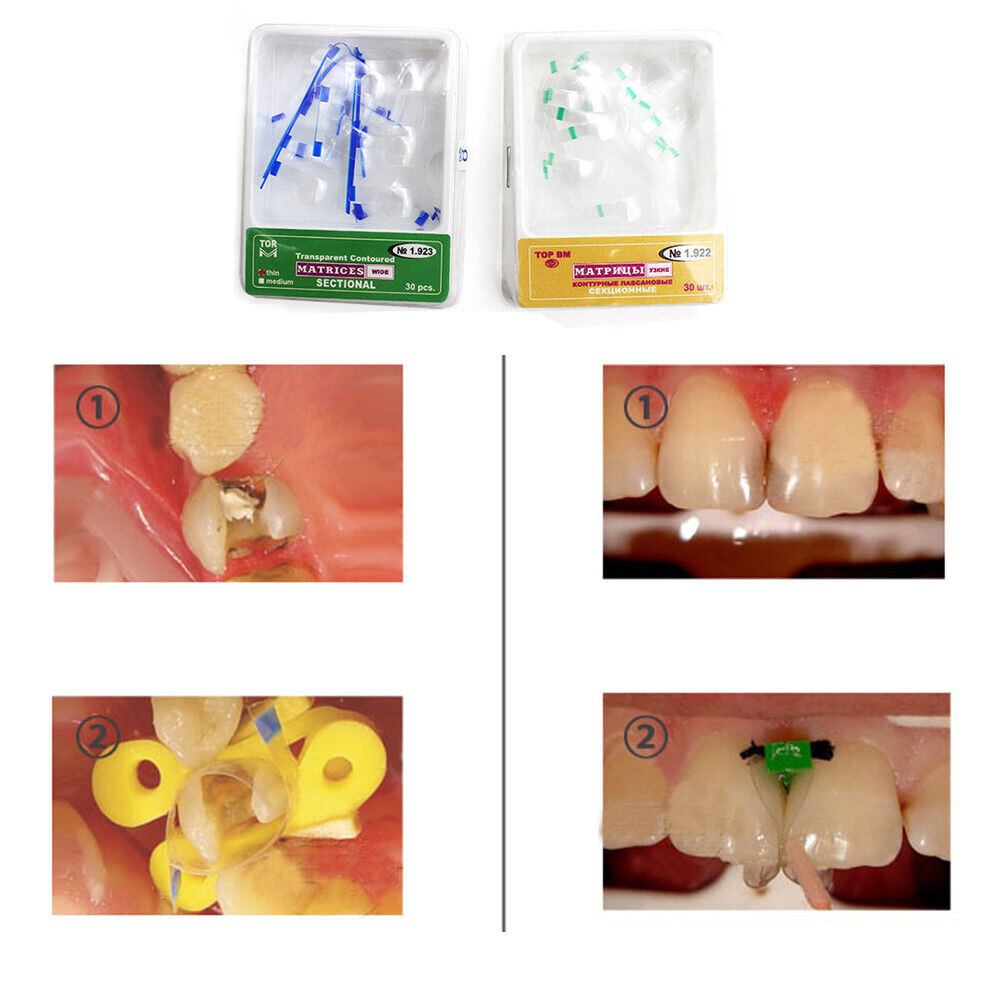 5 Boxes 30 Pcs/Dental Transparent Sectional Contoured Matrices Matrix Large