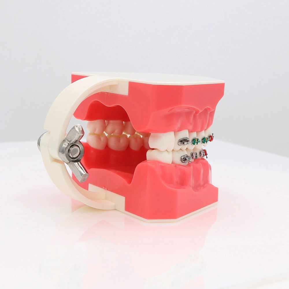 US Dental Typodont Demonstration Teach Teeth Model with Braces For Patient Study