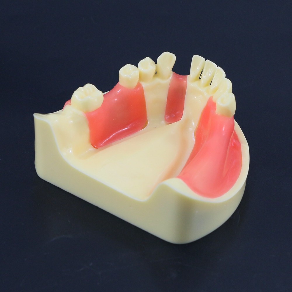 Dental Implant Practice Teeth Model Cutting Suturing Typodont M2004