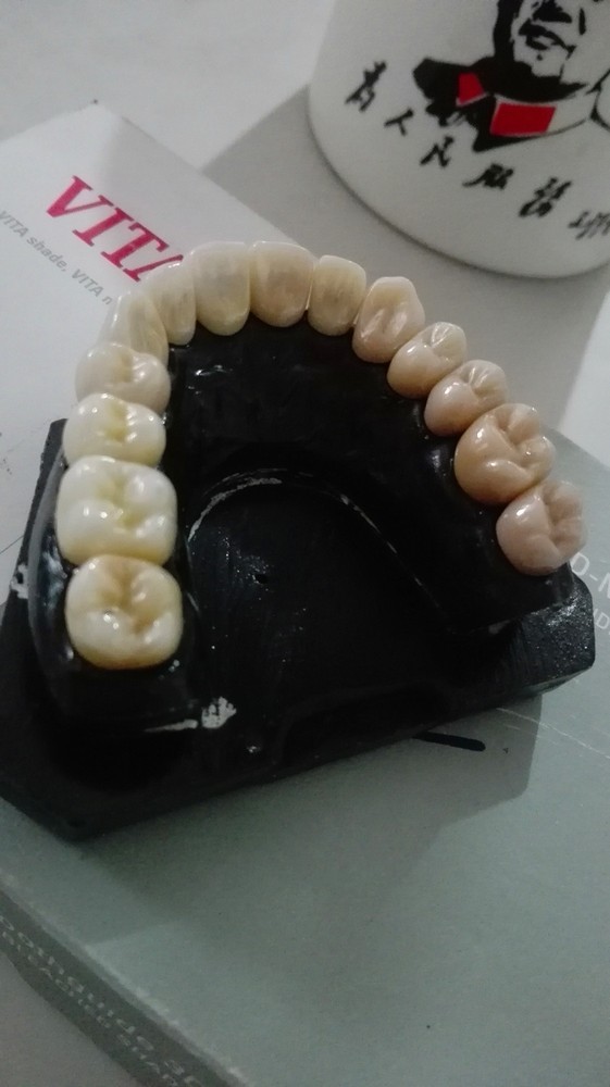 Dental Zirconia Ceramic Blocks/Discs for Open system Milling Machine Make Crowns