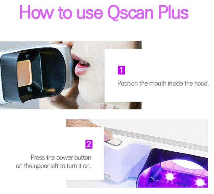 QScan Plus-UV plaque Screening Device