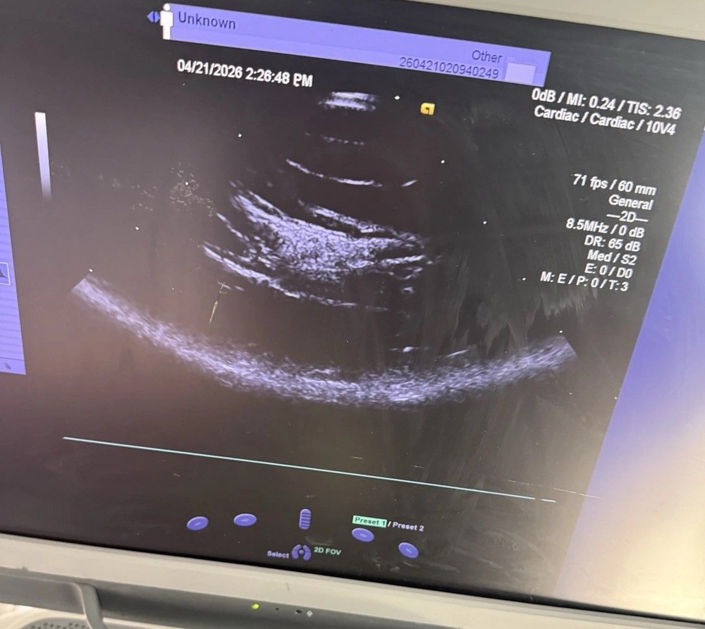 Siemens Acuson 10V4 Vector Array Transducer Probe