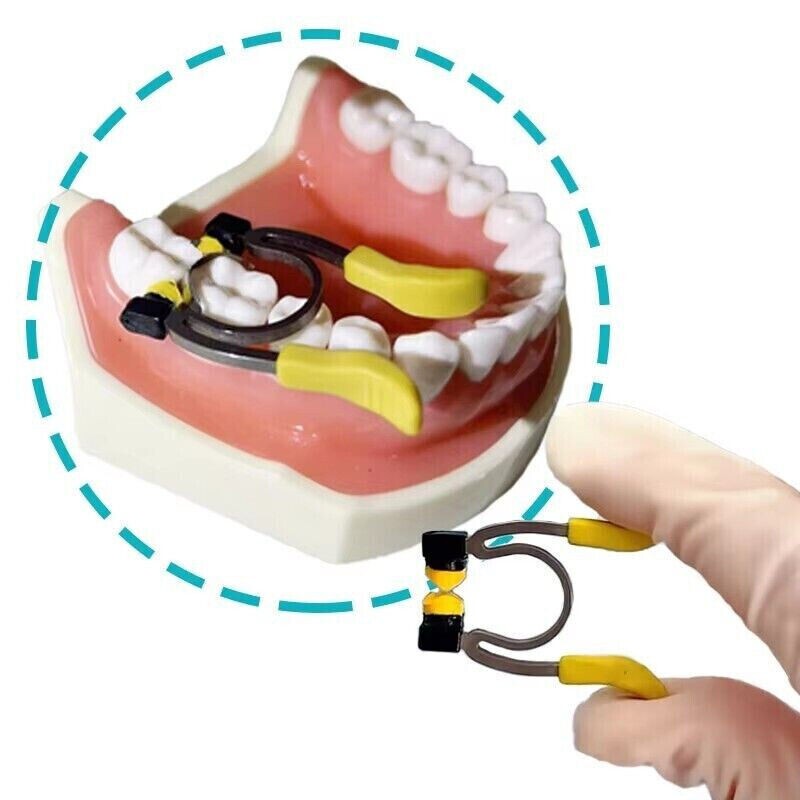 Dental Adaptive Wedges Paediatric Sectional Matrix System Kit B3 Ring Instrument