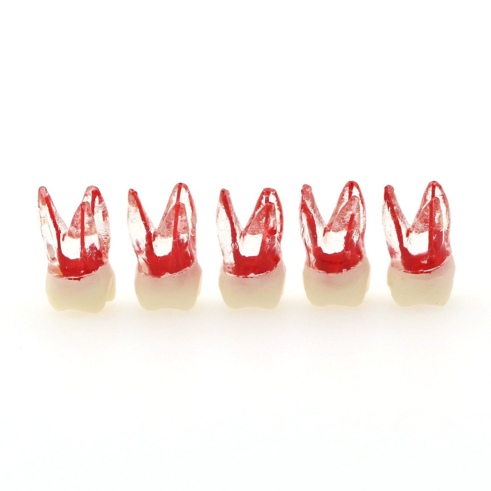 Dental Molar Endo Root Canal Teeth Modle- Study RCT Practice Block Pulp Cavity