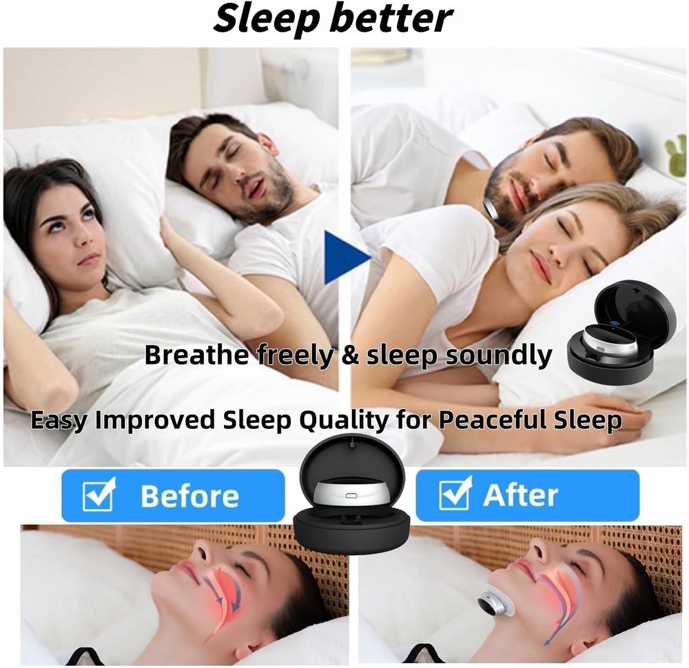 Pro Effective Smart Snoring Solution Device Breathe Easy, Sleep Better Tonight