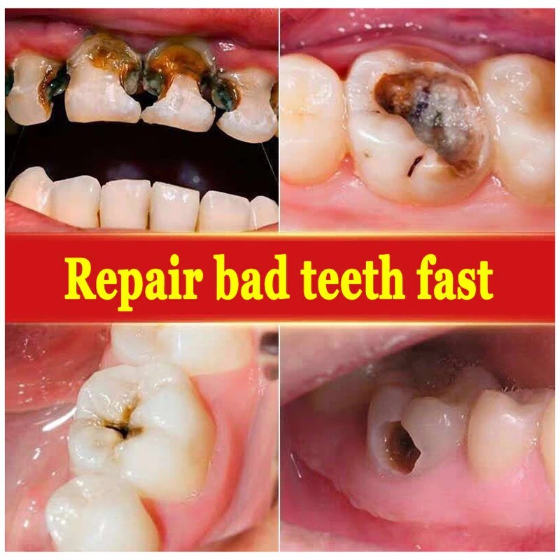 Sip-4 Toothpaste, Whitening Sp-4 Toothpaste, Sp-4 Probiotic Whitening Toothpaste