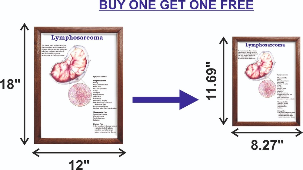 Lymphosarcoma Chart 12x18 inches