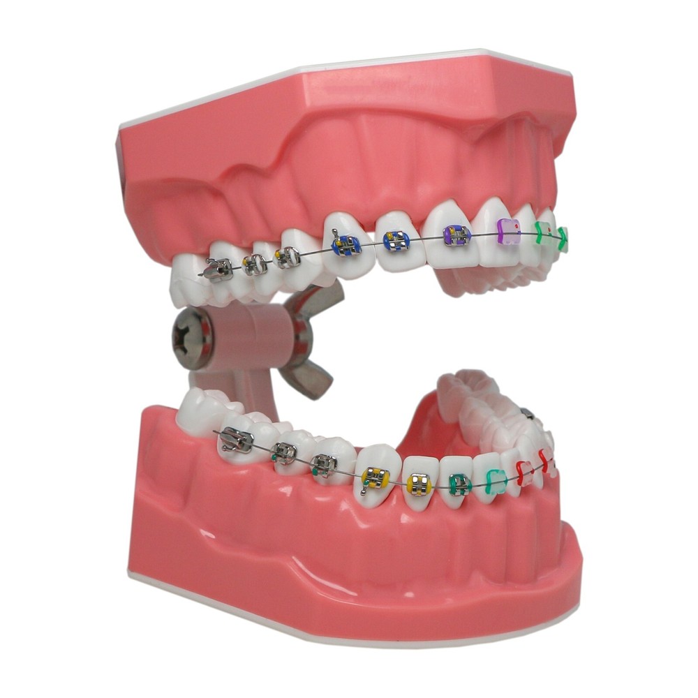 Dental Typodont Teeth Model 1:1 Teach Study Half Metal Ceramic Brackets Tubes