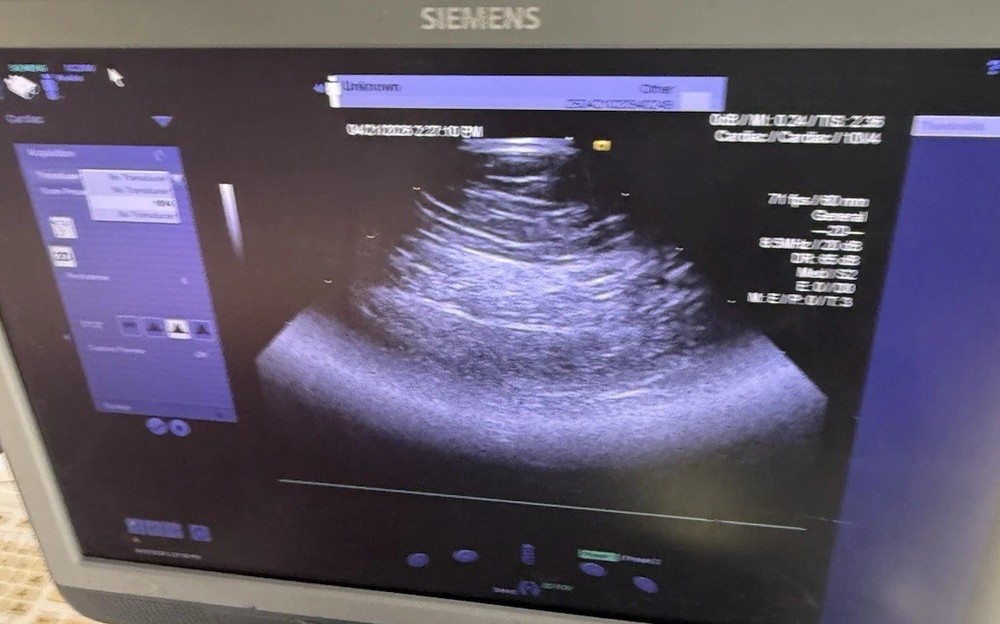 Siemens Acuson 10V4 Vector Array Transducer Probe