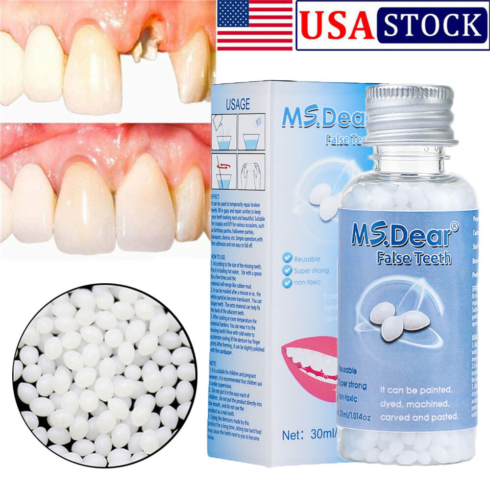 Tooth Repair Kit - Temporary Teeth Replacement Kit for Missing & Broken Teeth US