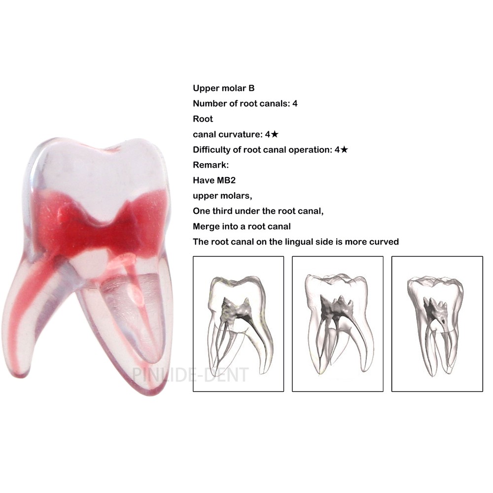 Dental Resin Root Canal Teeth Model Endo Practice Block RCT Pulp Cavity Study