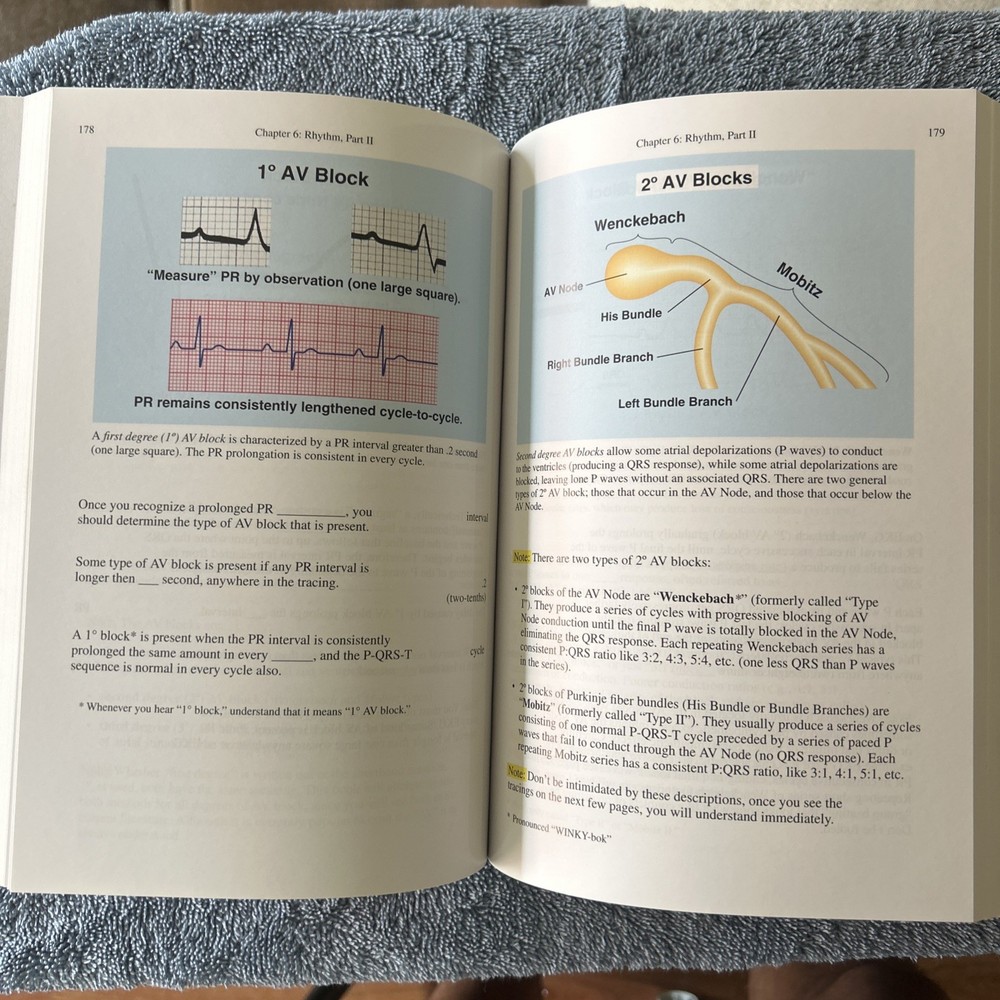 Rapid Interpretation of EKG’s