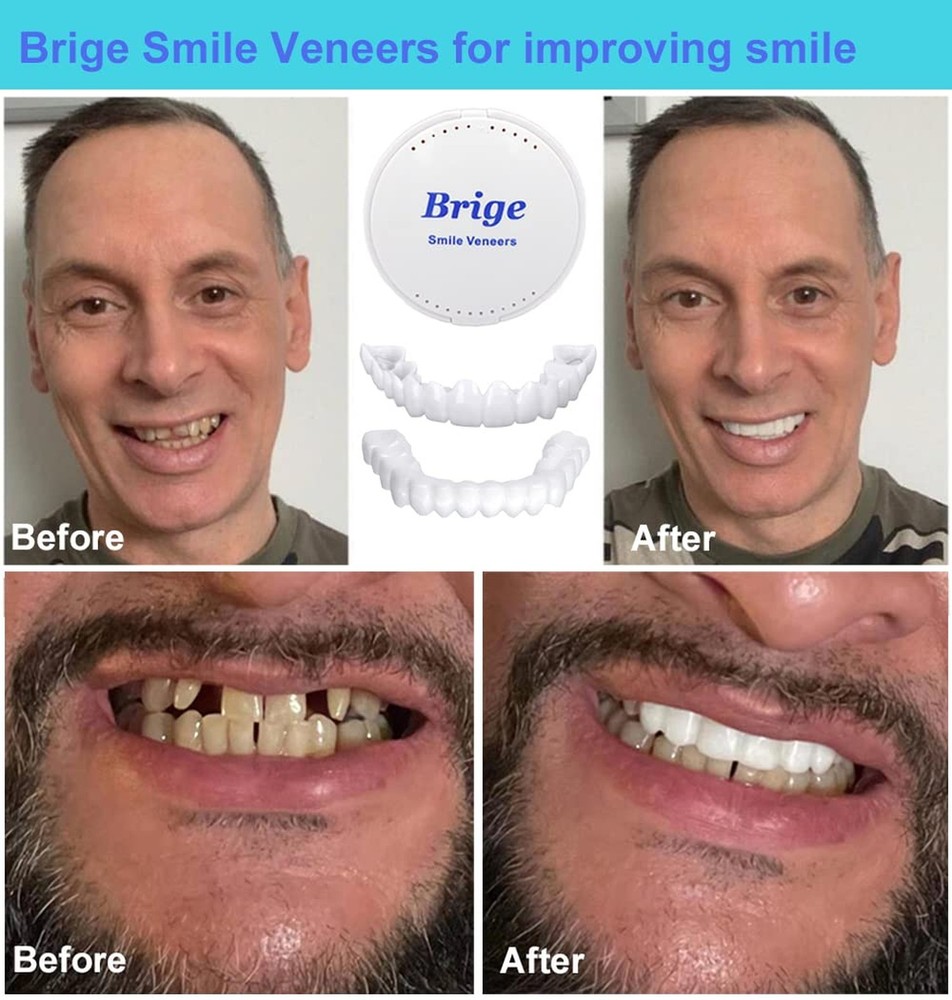 Smile Teeth Denture Temporary False Teeth Improve Smile