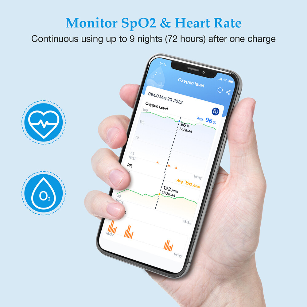 Checkme O2 Max Pulse Oximeter for SpO2 and Heart Rate Tracking Continuously