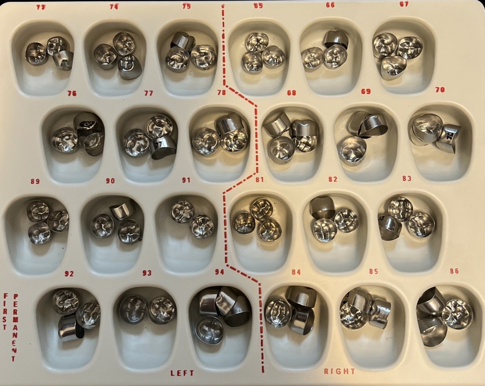 Rugby Lab Inc Permanent Aluminum Crowns