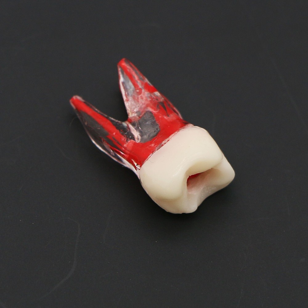Dental Typodont Endodontic Practice Pulp-Opened RCT Root Canal Teeth Model M8008