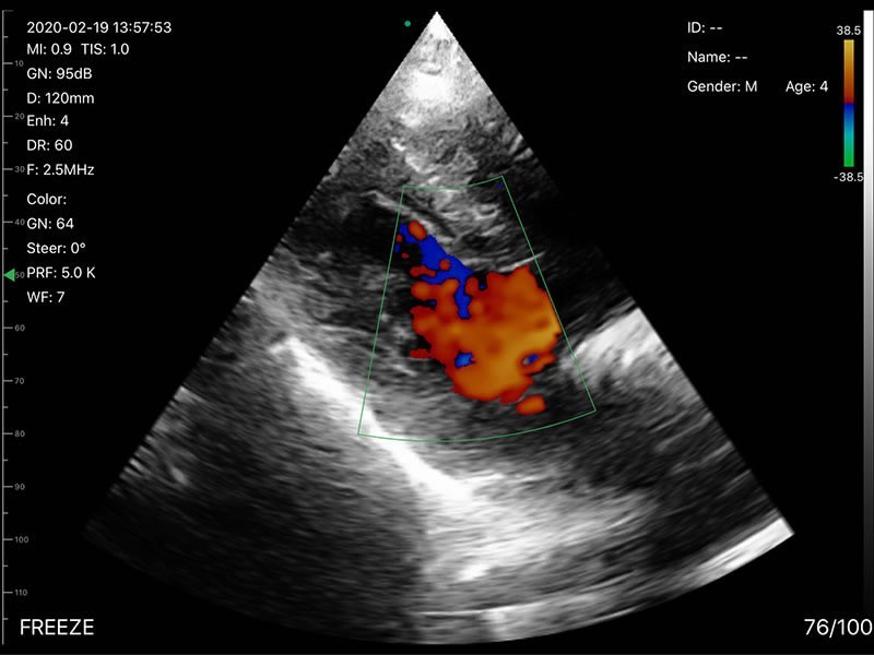 192 Elements convex/linear/phased array 3 in 1 Doppler Ultrasound Scanner