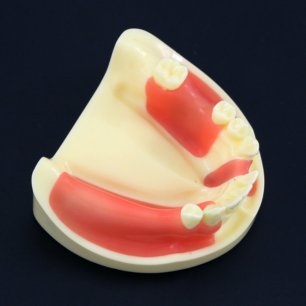 Dental Implant Practice Teeth Model Cutting Suturing Typodont M2004