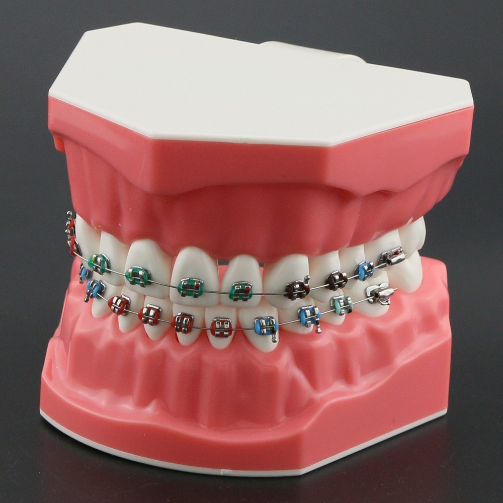 Dental Teach Typodont Demonstration Teeth Model with Brackets Patient N5006