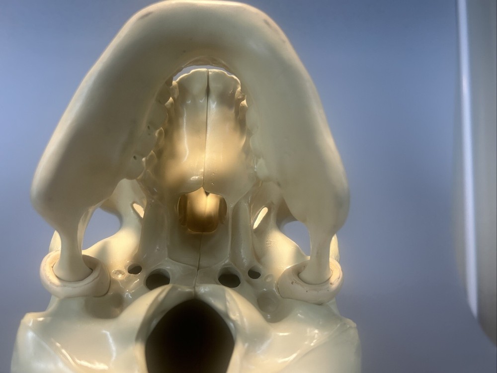 Synbone, Human Skull, Surgical, Training, Education,