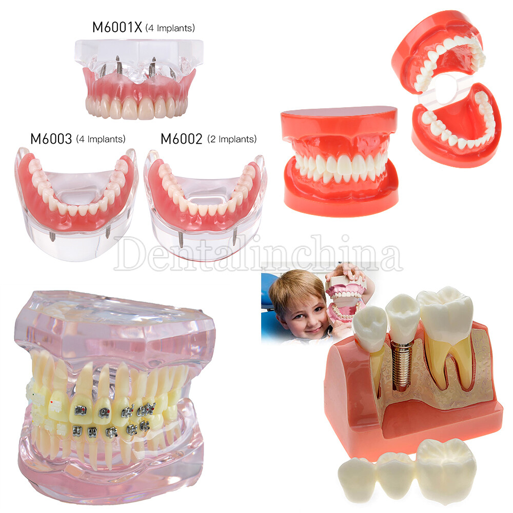Dental Oral Study Teach Standard Typodont Tissue Decomposition Teaching Model
