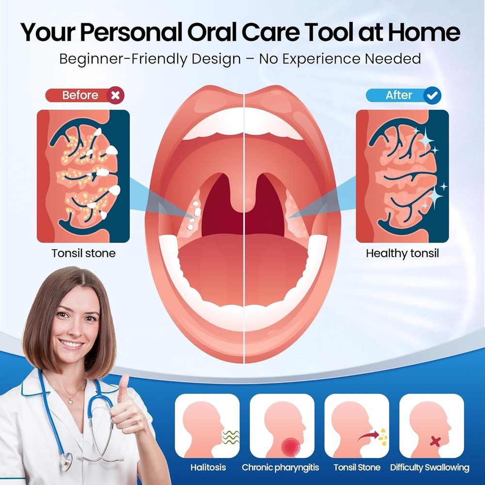 Tonsil Stone Remover with Camera 1080P Visual Tonsil Stone Removal Kit