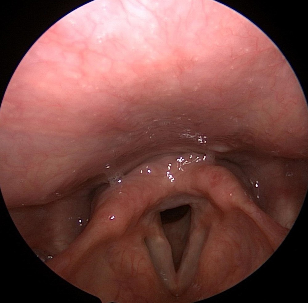 Rigid Endoscope Endoscopy for Dyonics HD USB Camera+Coupler+Light Source+Mount