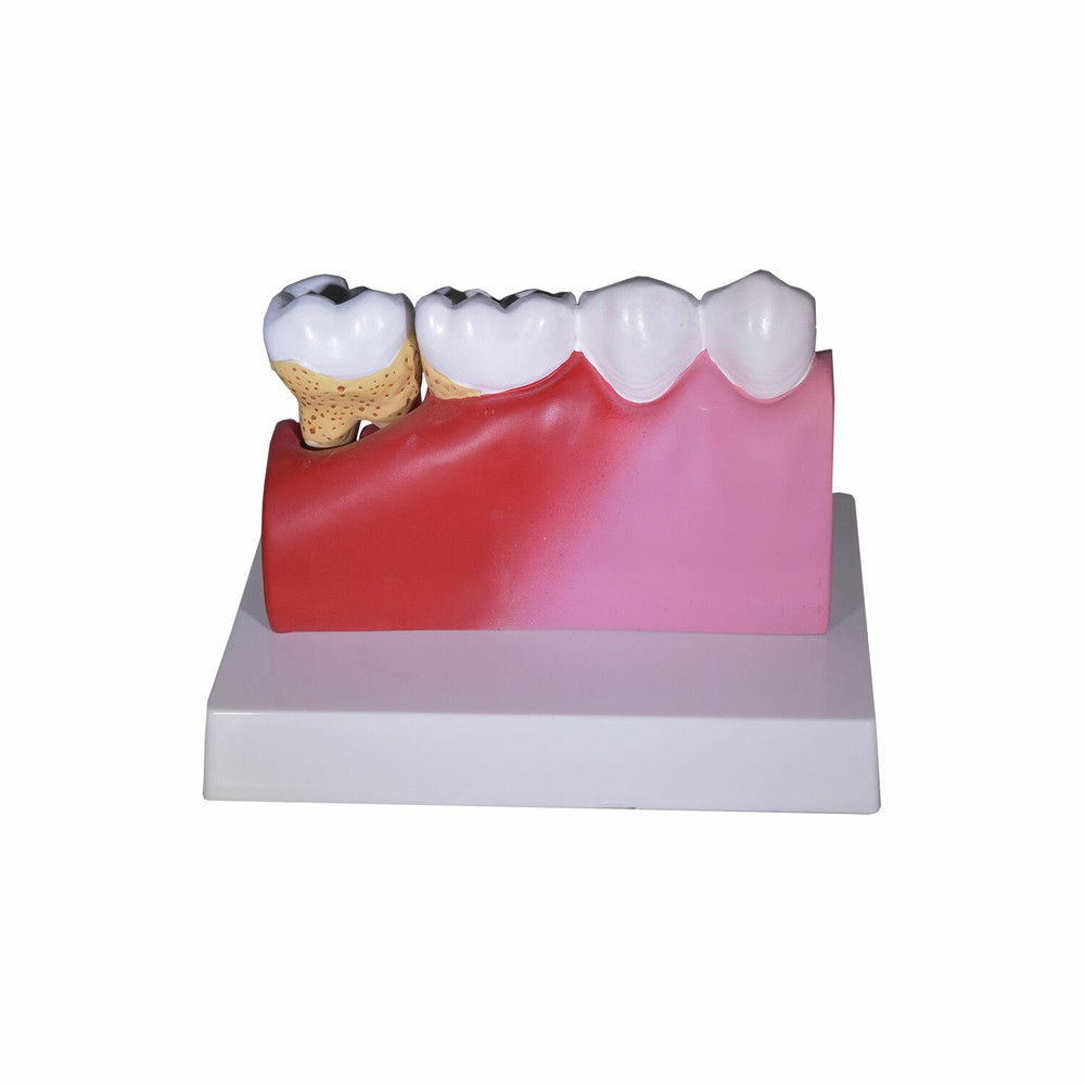 Redland Dental Demonstration Teeth Educational Model -fda