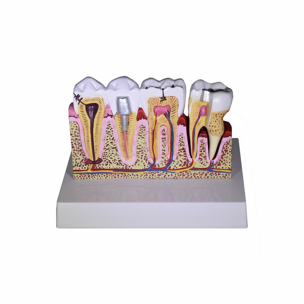 Redland Dental Demonstration Teeth Educational Model -fda