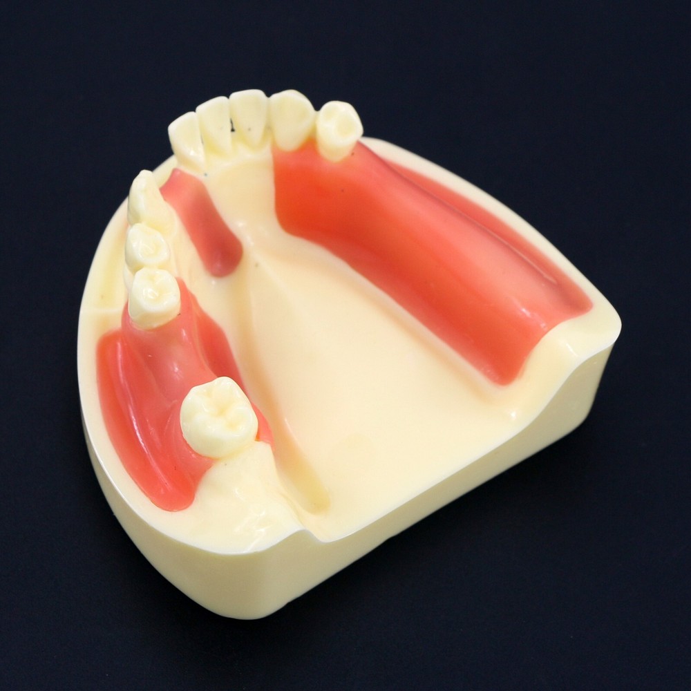 Dental Lower Jaw Implant Drilling Practice Teeth Model Removable Gingiva M2004