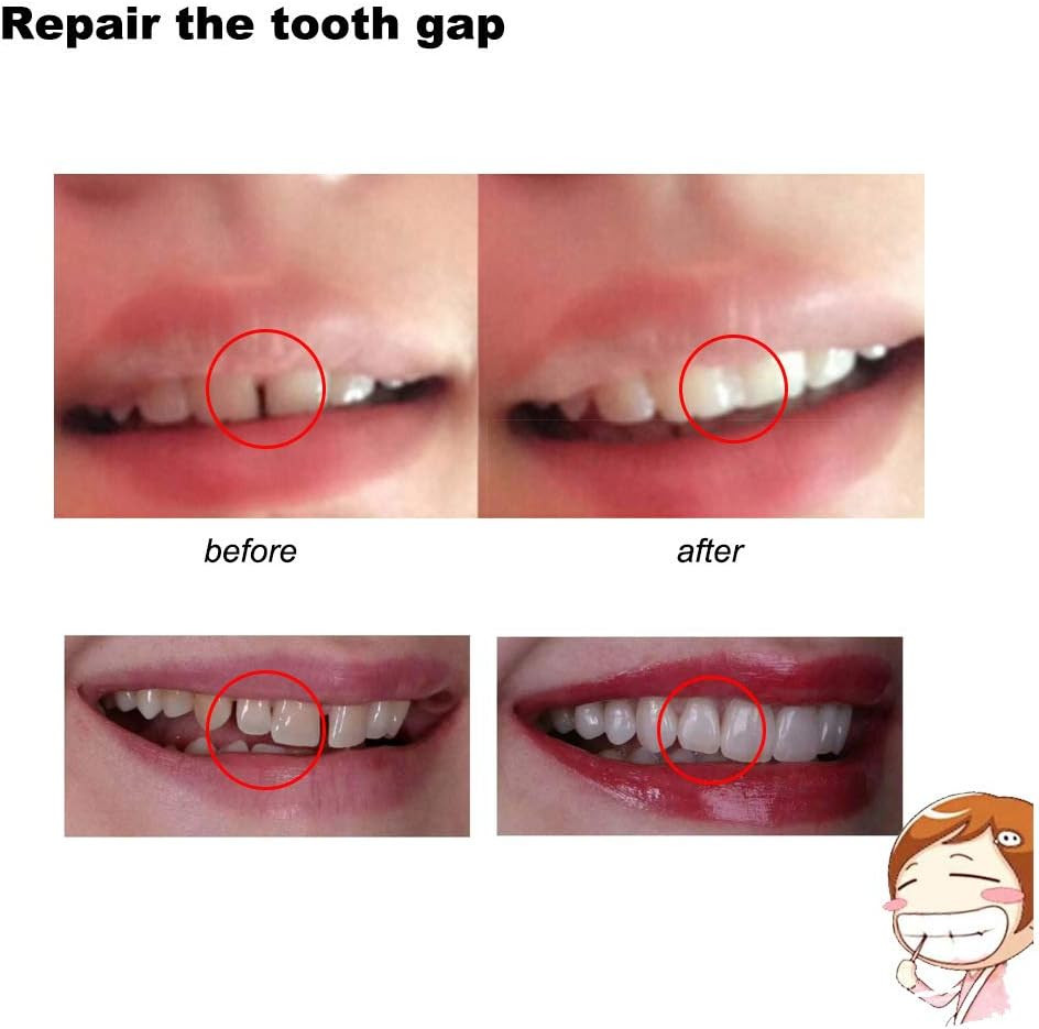3 Colors Temporary Moldable False Teeth Repair Replacement Thermal Fitting Beads