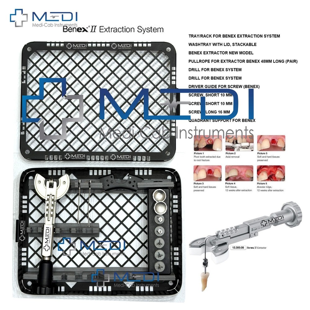 BENEX II Atraumatic Tooth Extraction Surgical Kit – Dental Removal System