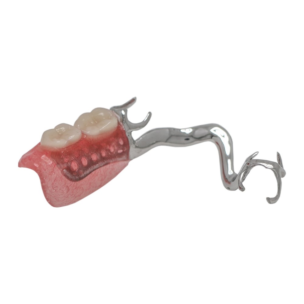 Dental Training Typodont Model with Removable Partial Denture Teaching Model