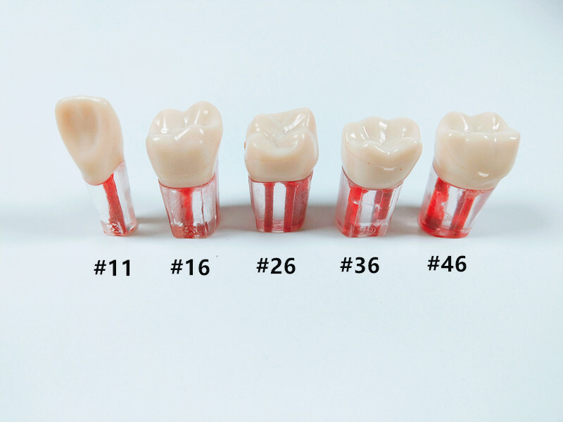 10Pcs Dental Root Canal Study Practice Model Red Pulp Files Molar Anterior Crown
