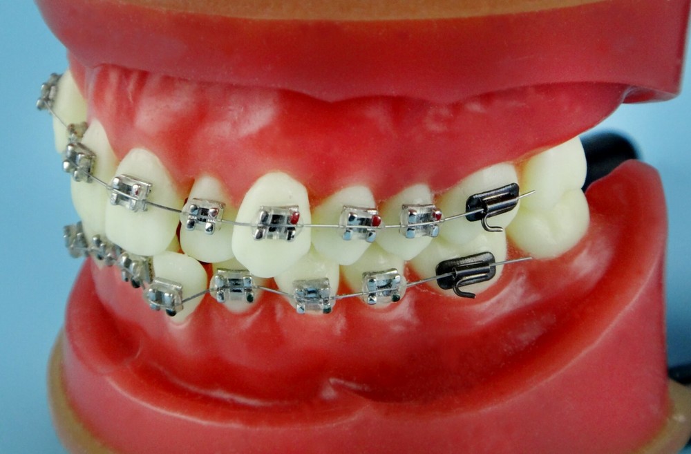Reusable Dental Typodont Orthodontics Model Wax Teeth Training Practice