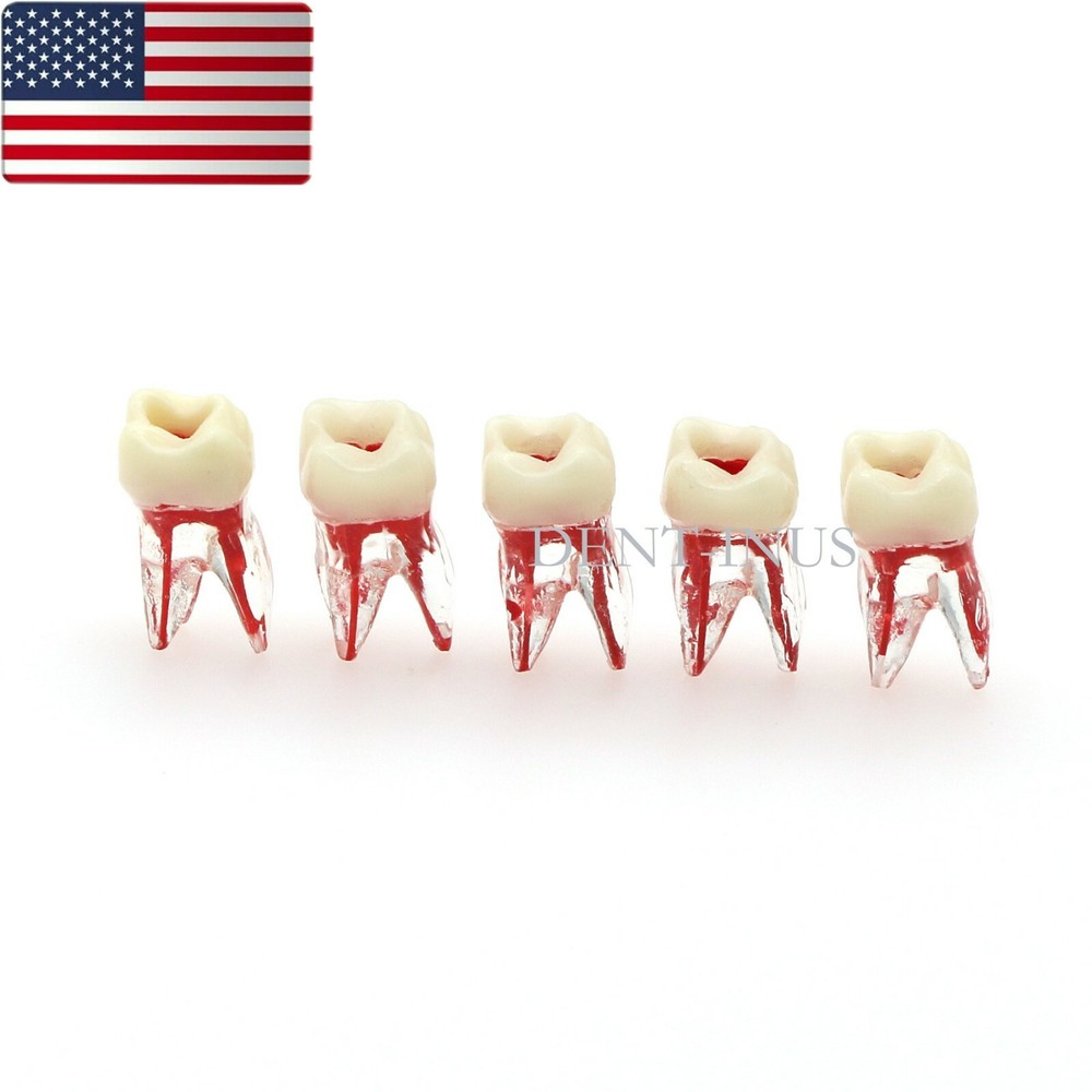 US Dental Endo Molar Root Canal Study Practice Block Pulp Cavity Model RCT/MTA