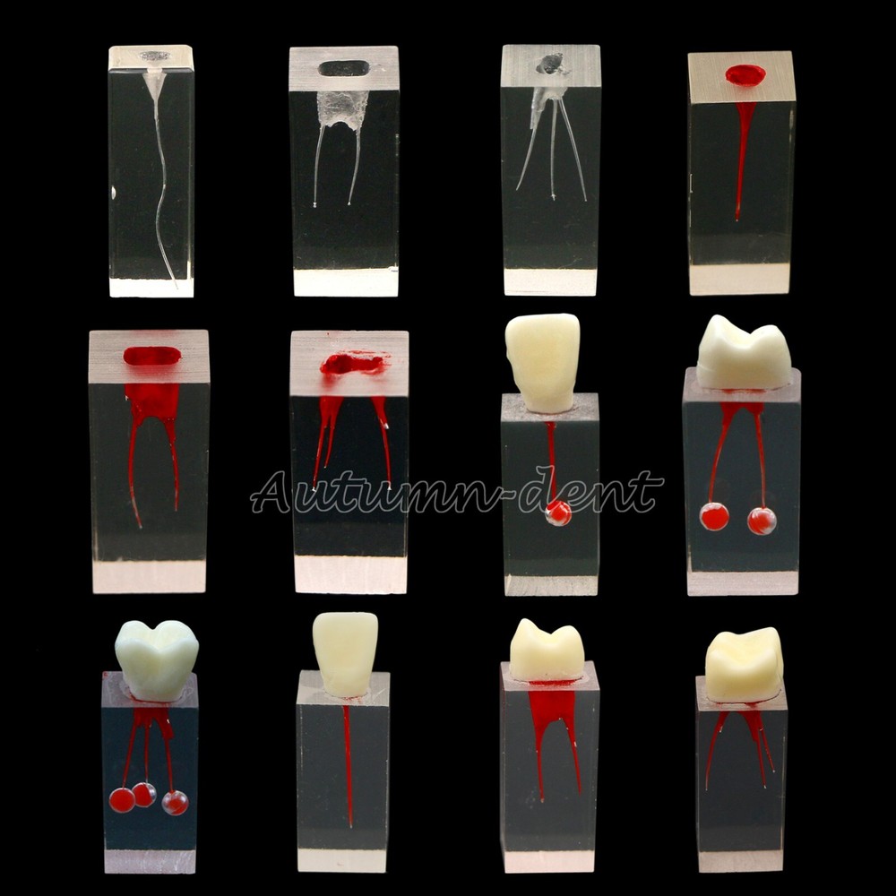 10Pcs Dental Endo Root Canal Teeth Models Practice Block RCT Pulp Cavity Study
