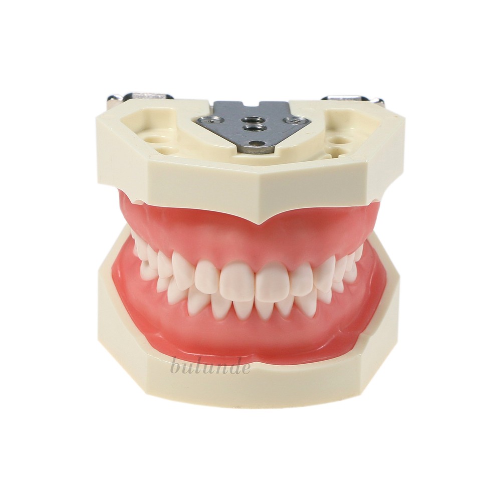 Dental Typodont Model Pathological Implant Ortho Perio Demo Practice Teeth Model