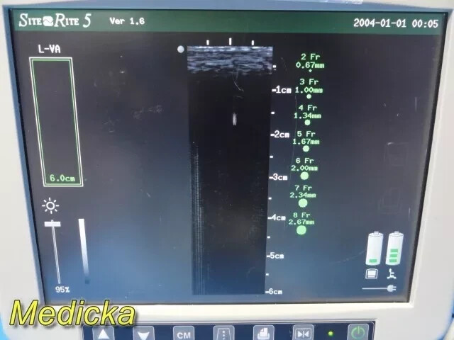 Chison Medical SR-6 Linear Array Vascular (L-VA) Imaging Probe ~ 36097