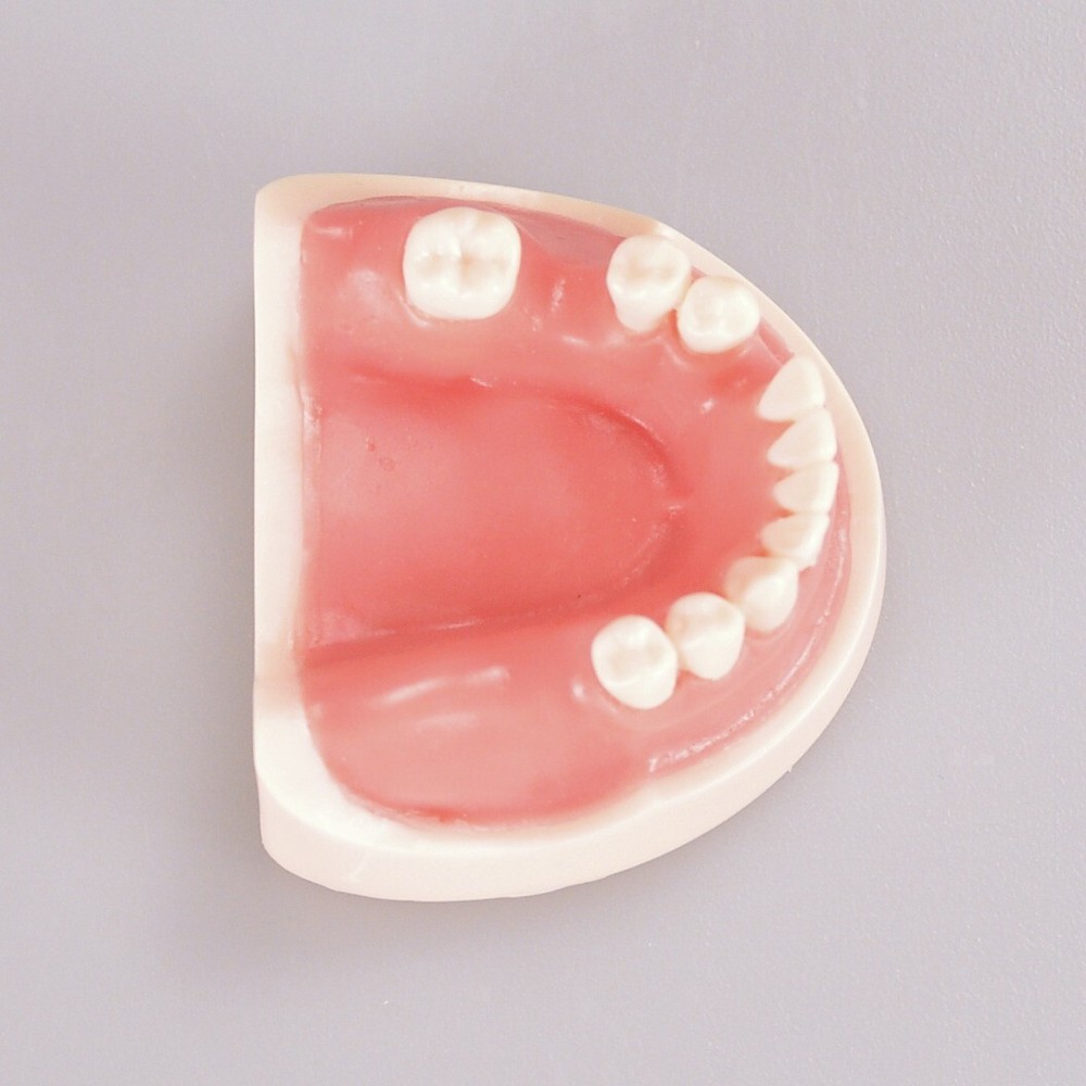 Dental Teeth Missing Implanting Typodont Training Dentistry Model Display