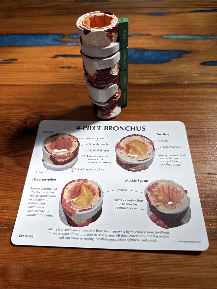 Bronchus GPI Anatomical Model 4-Piece With key