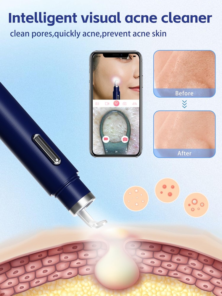 Visual Blackhead Remover Tools with Camera,Pimple Popper Extractor Tool Kit w...